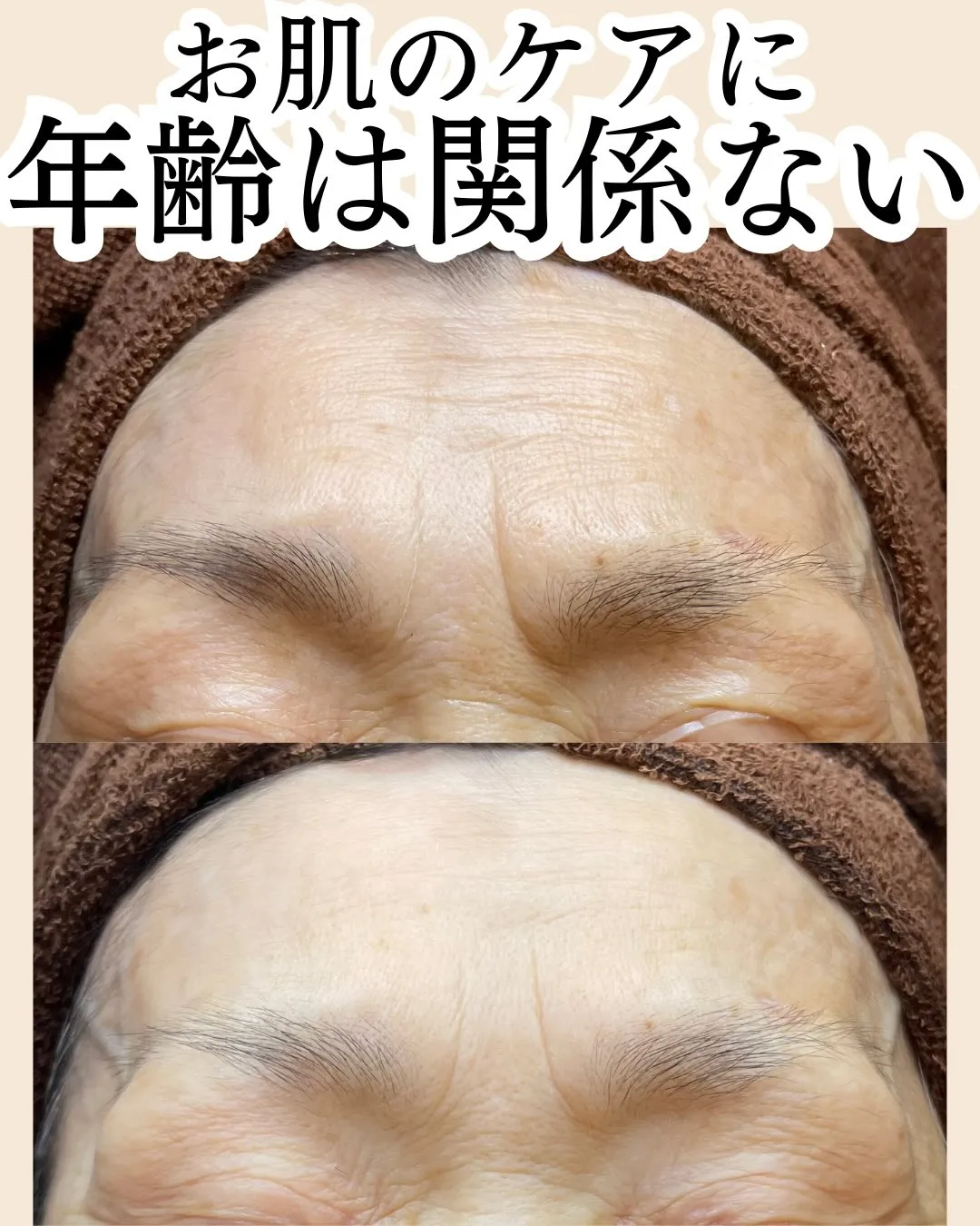 「もう歳だから…」とそのシミ・そのシワ、諦めてませんか？